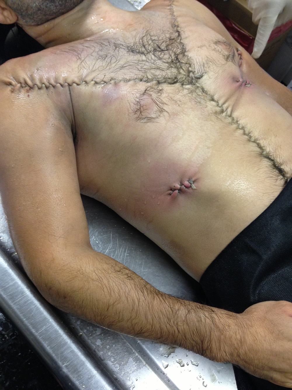 IbragimTodashevBody-9